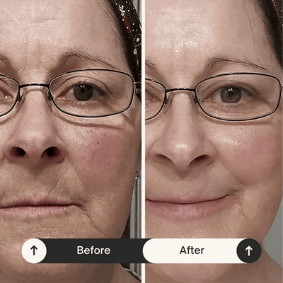 Silk Peptide Intensive Lifting Ampoule